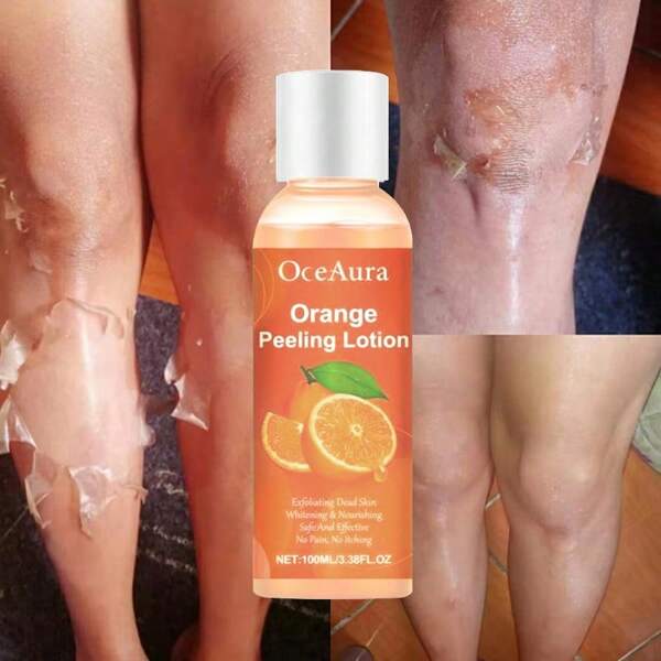 Fresh Orange Peeling Oil Removes Dead Skin And Keratin From Hands, Feet, And Body. The Lotion Brightens Skin Tone And Nourishes The Skin,Mother's Day Gift,Gifts For Her , Festive Gifts(Authenticity Guarantee OceAura)