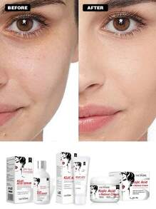 LANTHOME Kojic Acid皮膚護理3入組- Kojic Acid面部潔面乳100ml + Kojic Acid保濕霜50g + Kojic Acid精華液30ml,淡化膚色,保濕滋潤肌膚,修復暗沉 - 白色 - 查看 9