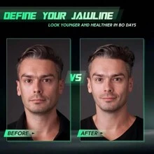 Outil d'exercice facial, dispositif de contour de la mâchoire, entraîneur de muscle de la mâchoire pour renforcer les masséters, outil de beauté du visage