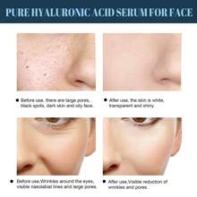 60pcs Protein Thread Absorbable Face Protein Lifting Line Anti-Aging Wrinkles Removal Skin Firming Moisturizing Care - Multicolor - View 6