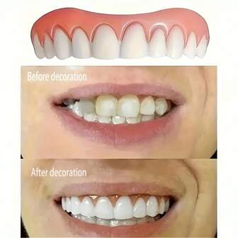 Silicone Dental Veneers Upper & Lower Teeth, Perfect Smile Decoration, Comfortable Dental Appliance, Gift For Holidays