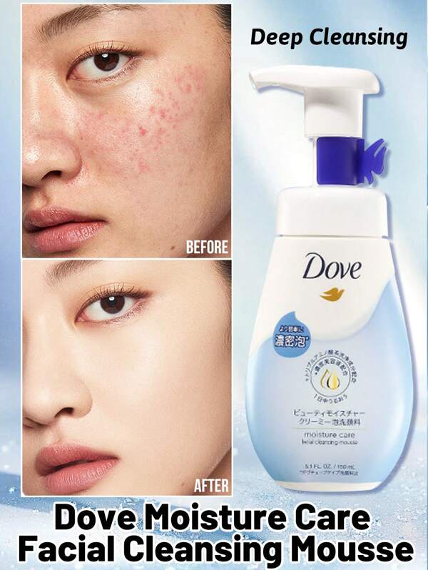Dove Spuma de curățare facială Moisture Care, formulă activă de aminoacizi, curățare profundă și purificare, infuzată cu esență de frumusețe, curățare blândă, fără etanșeitate după spălare, testată de experți, potrivită pentru curățarea zilnică a feței (150 ml/5,28 Fl Oz)