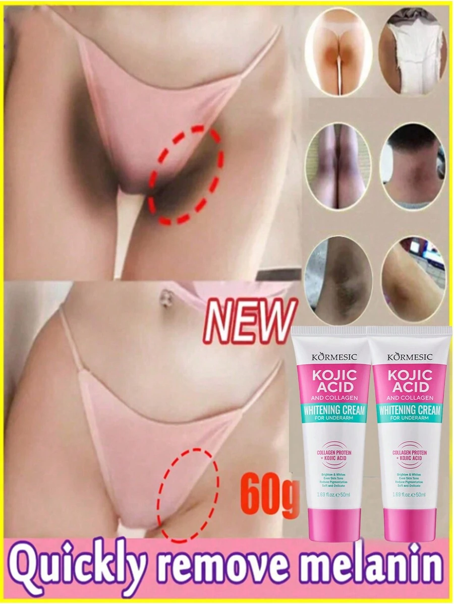 1 件腋下美白霜，可去除腋下、膝盖和肘部黑斑。含有植物精华和胶原蛋白，可美白、保湿和提亮肌肤。 - 彩色 - 查看 1