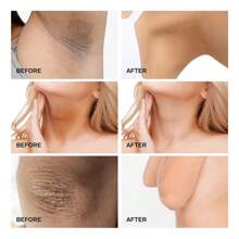 Crema Para Aclarar Las Axilas Piel Blanquear Hidratante Para - Blanco - Ver 8