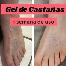 Gel de Masaje Bálsamo de Castaño de Indias Pferde - transparente - Ver 4