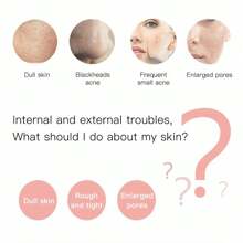 Ultrasonic Skin Scraping Pore Cleansing Device, Unisex Facial Deep Cleansing Beauty Tool