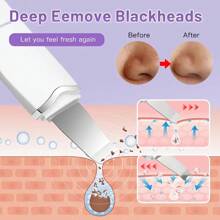 Ultrasonic Skin Scraping Pore Cleansing Device, Unisex Facial Deep Cleansing Beauty Tool