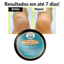 Lindaley Super Anti-Crack Heel Pad Smooth And Soft Heel Pad Repair Cracked Feet And Calluses - 白色 - 查看 7