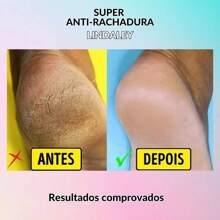 Lindaley Super Anti-Crack Heel Pad Smooth And Soft Heel Pad Repair Cracked Feet And Calluses - 白色 - 查看 5