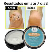 Lindaley Super Anti-Crack Heel Pad Smooth And Soft Heel Pad Repair Cracked Feet And Calluses - 白色 - 查看 1