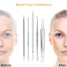 9 PCS Pimple Popper Tool Kit – Blackhead Extractors With 16-Heads & Tweezers For Nose & Face