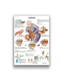 1 件装人体解剖肌肉系统海报解剖图人体医学壁画照片印刷医学教育办公室装饰壁画无框架 - 彩色 - 查看 57