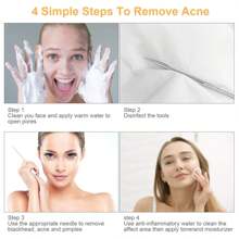 9 PCS Pimple Popper Tool Kit – Blackhead Extractors With 16-Heads & Tweezers For Nose & Face