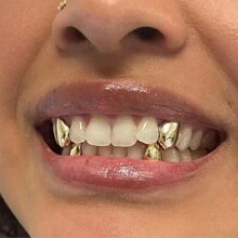 THATBOY 4pcs/Set New Style 18K Golden Plated Hip Hop Teeth Grillz With Star Cubic Zirconia Caps Micro Pave Top & Bottom Charm Grills For Men Women Jewelry - Multicolor - View 3