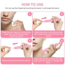 2-8mm Auto Skin Tag Remover Kit - Painless,And Safe 2-In-1 Skin Tag Removal , Including Face, Neck, And Body,Gentle, And Safe For Most Body Parts - 粉色 - 查看 3
