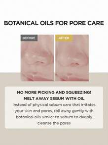 SKIN1004 200ml 马达加斯加积雪草轻盈卸妆油，轻盈油状质地，易乳化配方，不油腻清爽，温和卸妆，韩国化妆品，200ml/6.76 液体盎司。 - 200ml - 查看 4