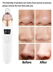 Limpiador facial eléctrico portátil 5 en 1 para aspirar los poros y eliminar los puntos negros