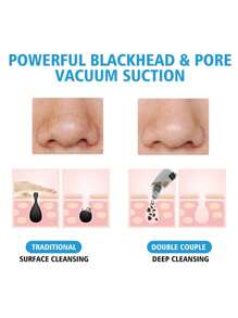 Limpiador facial eléctrico portátil 5 en 1 para aspirar los poros y eliminar los puntos negros