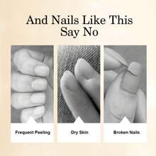 LIMEGIRL 15/10ml Gel Base Coat And Top Coat Set, Includes Cuticle Oil, 3pcs Gel Nail Polish Cuticle Care Set, No Wipe Base Coat, Glossy Top Coat And Nail Polish