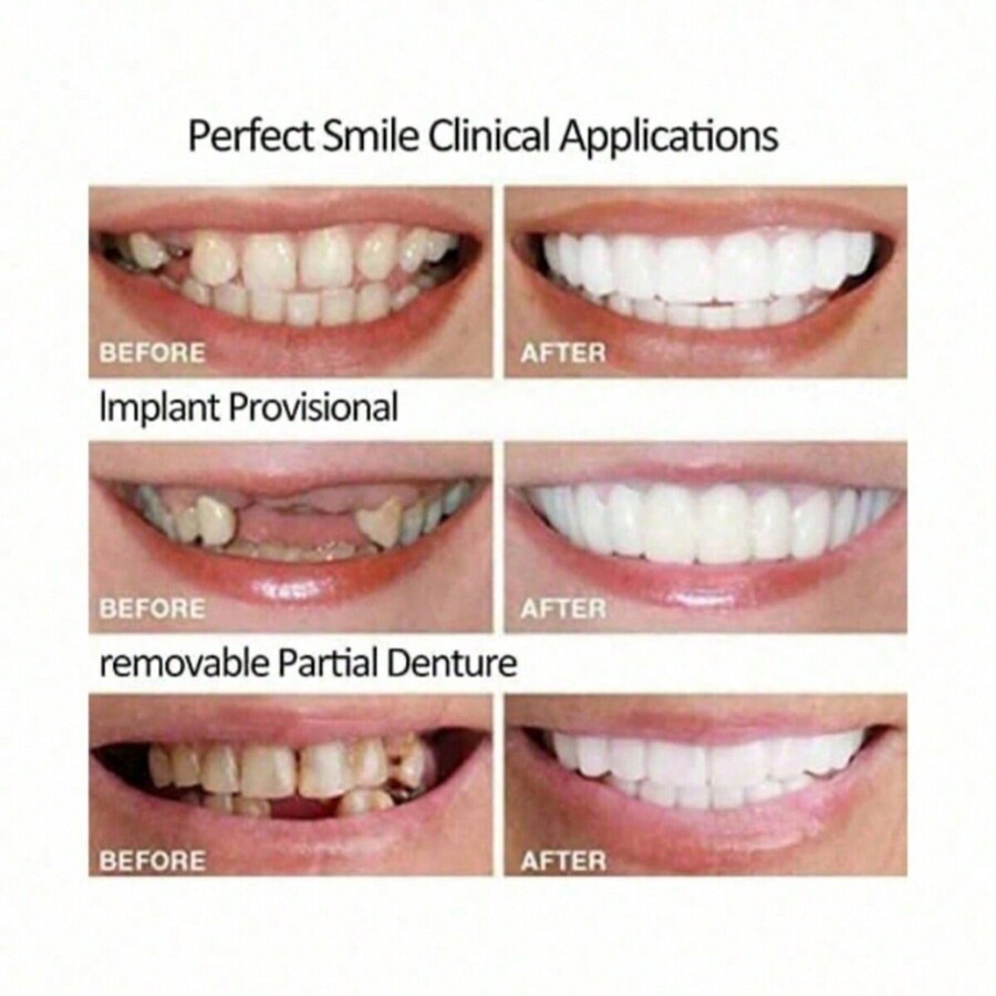 1 set silicone fake teeth smile decoration top bottom teeth soak in