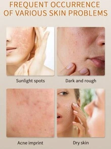 520g Niacinamide Pure Essence, Suitable For Face And Body, Whitening And Moisturizing, Suitable For All Skin Types, Home Use - Clear - View 6