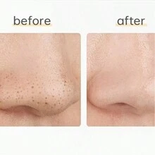 1pc Black Head Remover, Manual Blackhead & Pimple Extractor Tool For Nose Pore Cleansing,Blackhead Remover,Beauty,Skin Care Products,Spa,Self Care,Skin Care Tools,Face Care,Esthetician Supplies,Skin,Face Wash,Facial