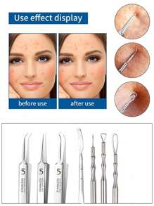 7PCS/Set Acne Blackhead Removal Needles Stainless Steel Black Spot Blemish Pimple Removal Needle Deep Cleansing Tool Face Skin Care Kit