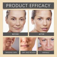 SADOER Creme Facial de Abelha OUHOE, Bálsamo Facial Suavizante e Clareador, Hidratante Suave, Ointment de Cuidado da Pele Suavizante e Hidratante