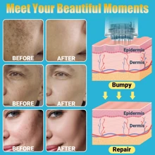 100% 原装微针笔，家用电动皮肤印章，可使面部毛发胡须的产品吸收率提高高达 300%（5 档速度控制），型号 A10 - 中紫紅色 - 查看 11