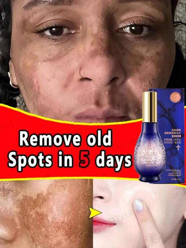 100ml Epydorin Boson Apple Fruit Cell Active Essence, Pore Tightening Moisturizing Essence, Anti-Aging & Skin Brightening