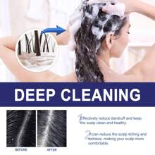 100ml Hair Shampoo, Strengthens Hair, Removes Dandruff, Deep Cleanses Scalp, Promote Hair Growth & Thickness