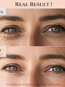 Beauty Of Joseon Revive Eye Serum30ml With Ginseng Cleansing Oil 210ml For Fine Lines Dark Circles Wrinkles Makeup Remover For Sensitive Skin