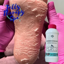 Removedor callos hiperqueratosis, pedicura spa, manicura, cuidado del pie, humectación de los talones, removedor liquido 1000ml - Blanco - Ver 2
