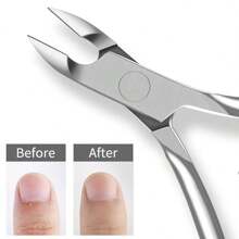 Kit de Cuidados com as Unhas, Cortador de Cutículas, Alicates de Cutícula, Kit de Remoção de Unhas Encravadas, Kit de Cutículas em Aço Inoxidável, Alicates de Cutículas, Empurradores de Cutículas, Kit de Manicure, Kit de Pedicure