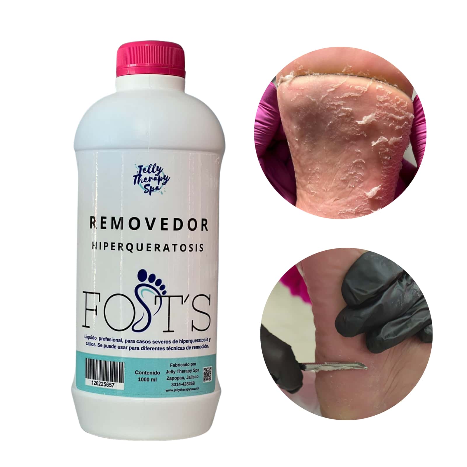 Removedor callos hiperqueratosis, pedicura spa, manicura, cuidado del pie, humectación de los talones, removedor liquido 1000ml - Blanco - Ver 1