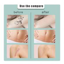 1 pieza Parche corrector para cicatrices/tono de piel lunar, corrector impermeable para cubrir marcas de nacimiento, cicatrices, tatuajes y manchas en el Body