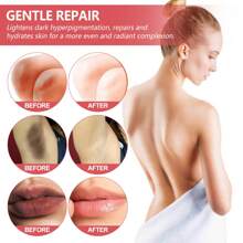 Whitening Serum, Armpit Joint Beauty Whitening Lip Pink Color Treatment - 紅色 - 查看 7