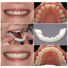 2 pezzi Apparecchi ortodontici dal colore naturale che aiutano a ottenere un sorriso perfetto, adatti per varie occasioni: per attività sociali, per diverse forme di denti, universali, facili da installare