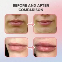 20g Hydrating Lip Balm - Deep Nourishment, Smoothing Formula, Reduces Lip Lines, Effortless Application, Long-Lasting Moisture