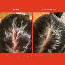 Hair Oil Strengthening Serum 1.8FL Oz - 彩色 - 查看 8