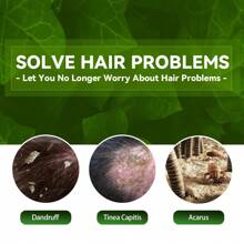 Shampoo,  Ringworm Anti-Itch Shampoo Anti-Hair Loss Refreshing Oil Control Hair Care Anti-Dandruff Anti-Itch Shampoo - 1 - View 6