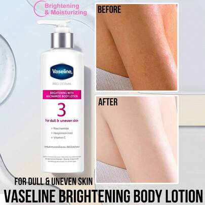  Vaseline Brightening Moisturizing Lotion, pakt een doffe, ongelijkmatige teint aan, verheldert de huidskleur, egaliseert de teint, hydrateert en voedt, zichtbare resultaten in 7 dagen, klinisch bewezen, bevat 99% pure niacinamide.