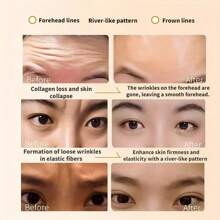 2pcs Reusable Forehead Lift Tapes, Washable & Adjustable For Men & Women, 3D Contoured Face Shaping, Wrinkle Minimizing, Blackout Sleep Or Daytime Use, Fits All Head Sizes, Comes With Storage Bag