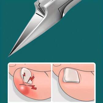 Professional Stainless Steel Toenail Clippers - Hypoallergenic, Precision Ingrown & Thick Nail Trimmer, Odorless Foot Care Tool,Nail Supplies,Nail Tools,Nail Art Tools,Back To School,Nails,Nail Tools For Press On Nails