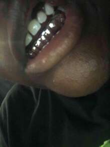 1 peça Grillz estilo Hip-Hop com 8 dentes lisos