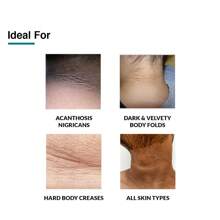 FIXDERMA Nigrifix Cream For Acanthosis Nigricans With Lactic Acid | Dermatologist Tested Retinol Cream | Useful For Dark Body Parts Like Neck, Ankles, Armpits & Elbows –3.52 FlOz - 1 - 查看 4