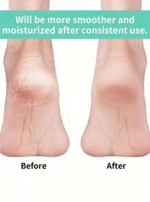 2 件装脚跟保护套适用于冬季干燥足部皮肤保湿套，去角质柔软脚跟套，适用于皮肤干燥开裂的男女