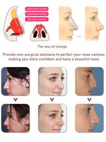 Dispositivo para moldear la nariz, 1/3 juegos: pinza nasal invisible e indolora - Corrector de entrenamiento facial