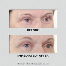 Peter Thomas Roth | Instant FIRMx Temporary Eye Tightener | Firm And Smooth The Look Of Fine Lines - 黑色 - 查看 10