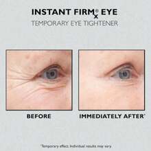 Peter Thomas Roth | Instant FIRMx Temporary Eye Tightener | Firm And Smooth The Look Of Fine Lines - 黑色 - 查看 5